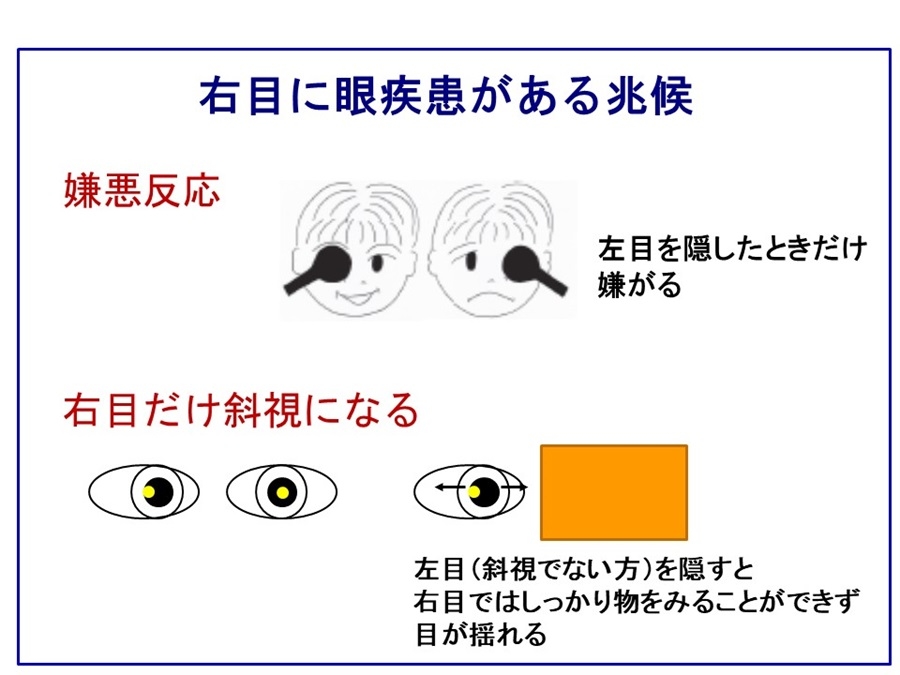 右目に眼疾患がある兆候