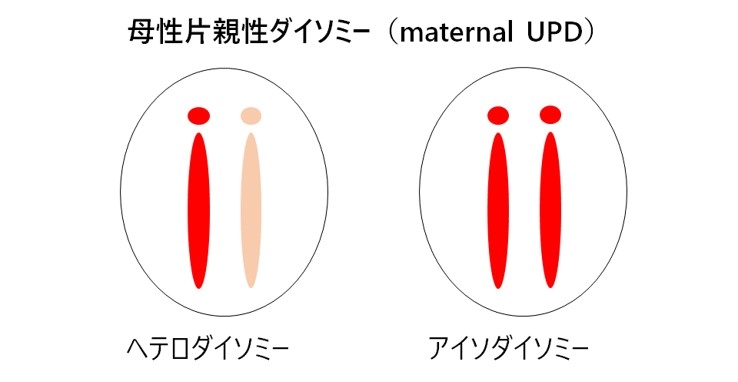 インプリンティング疾患 | 国立成育医療研究センター